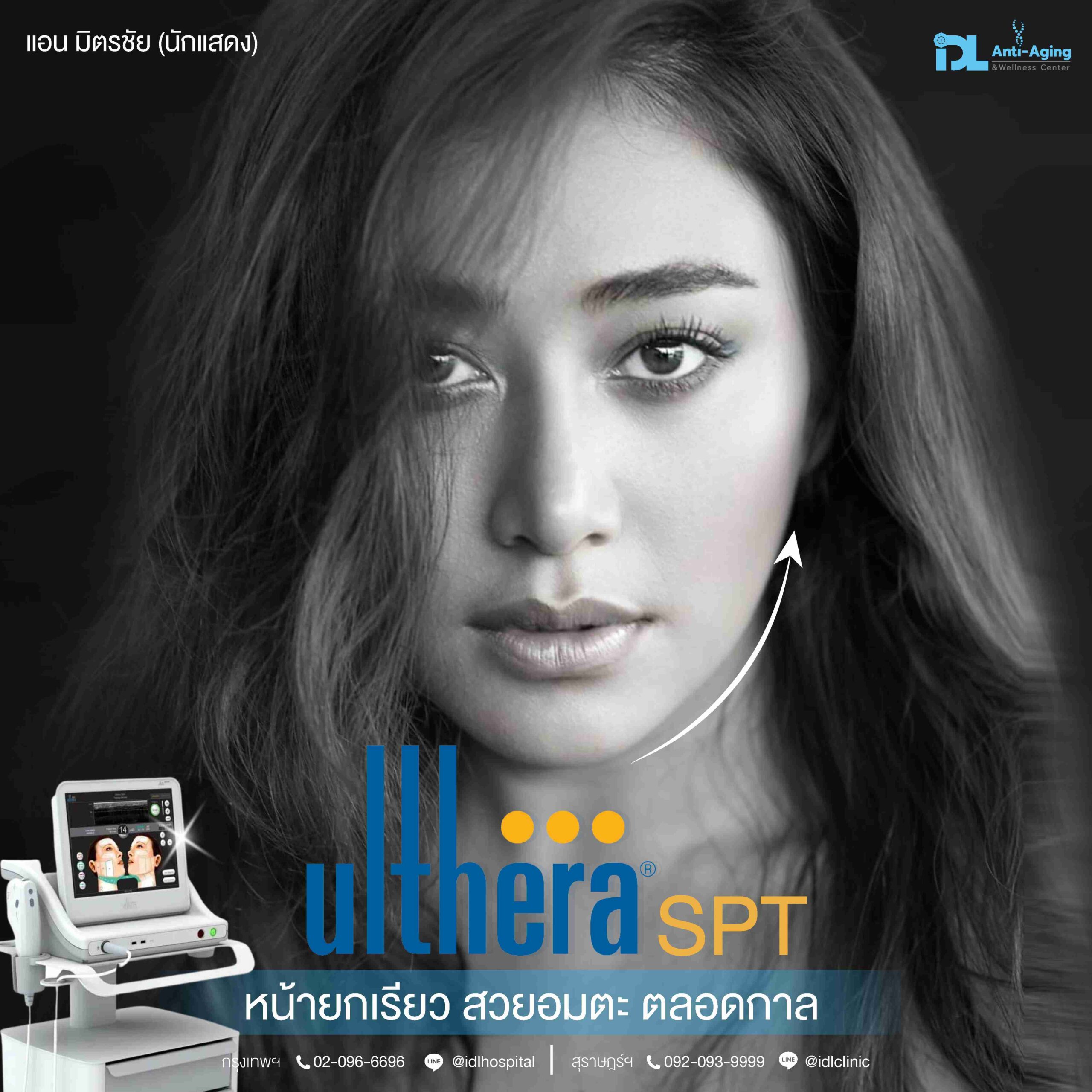 Ulthera SPT สวยอมตะ-01