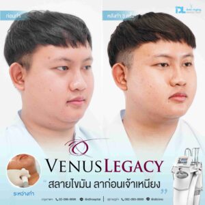 Venus
