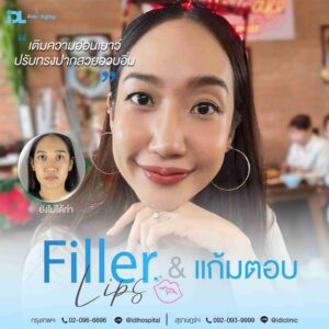 Filler