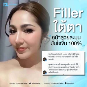 Filler