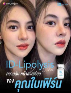 lipo