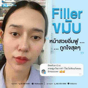 Filler