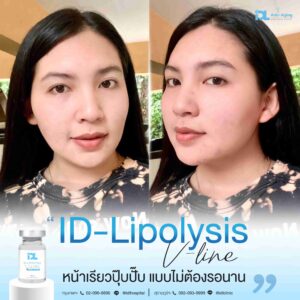 lipo