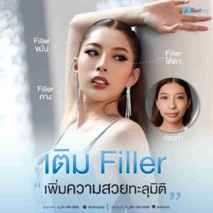 Filler