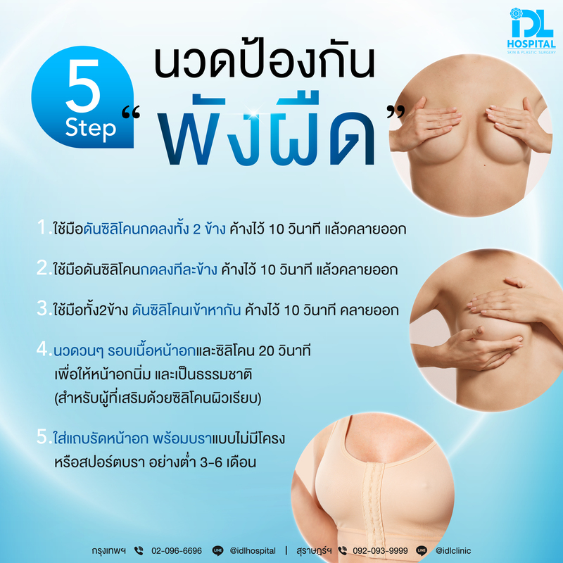 เทคนิคนวดหน้าอกหลังเสริมหน้าอก
