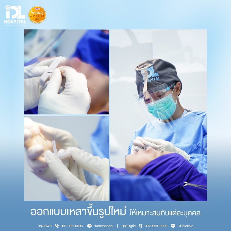 ออกแบบเหลาซิลิโคนจมูก ขึ้นรูปใหม่ 100% ให้เหมาะสมกับแต่ละบุคคล เสริมจมูก 3D Nose