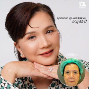 รีวิว ดึงหน้า IDL