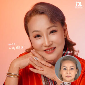 รีวิว ดึงหน้า IDL