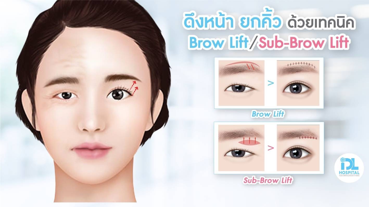 ดึงหน้า