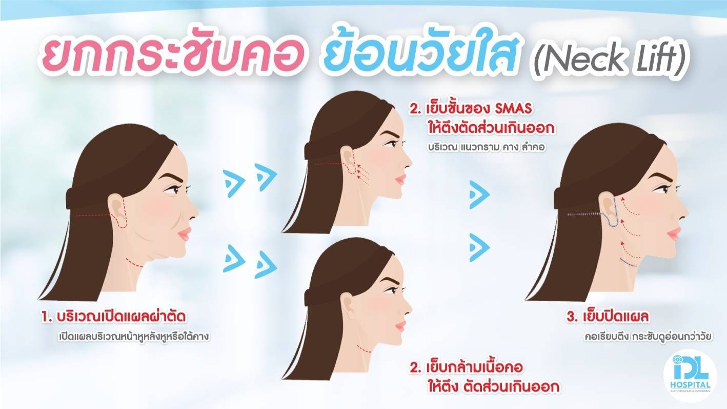 ยกกระชับคอ