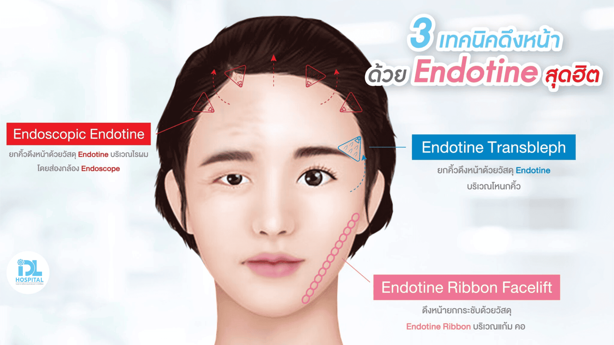 endotine