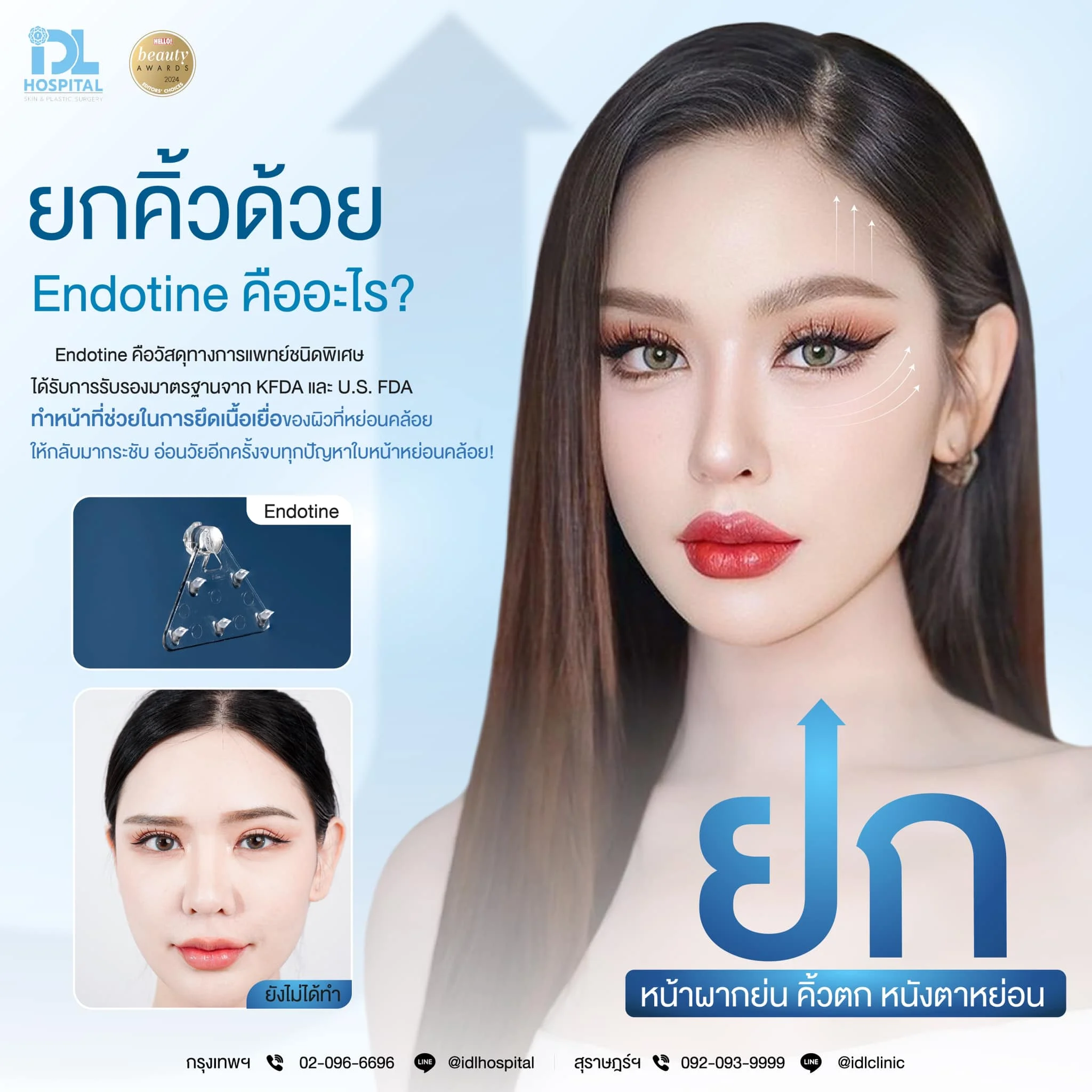 Endotine คืออะไร