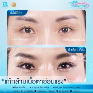 รวมเคสรีวิวจากลูกค้าจริงที่ IDL Hospital