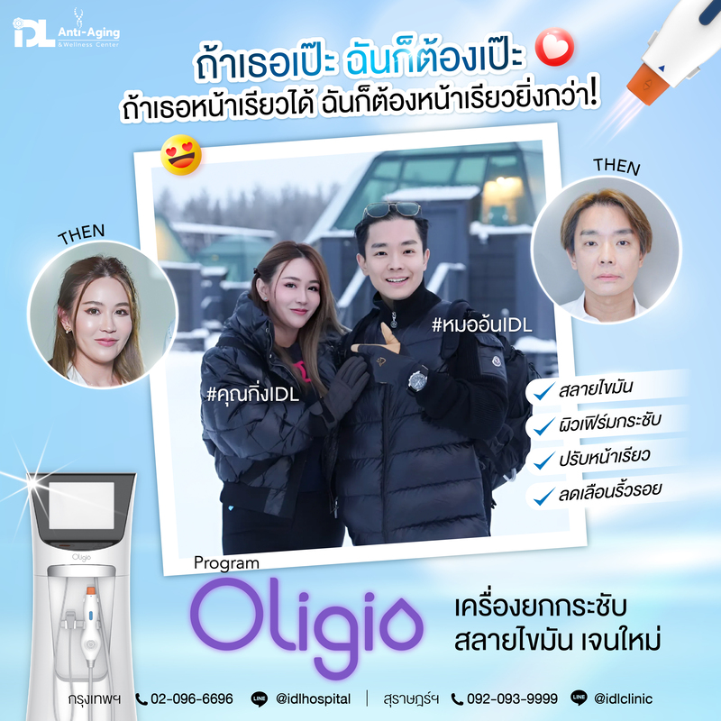 โปร Oligio