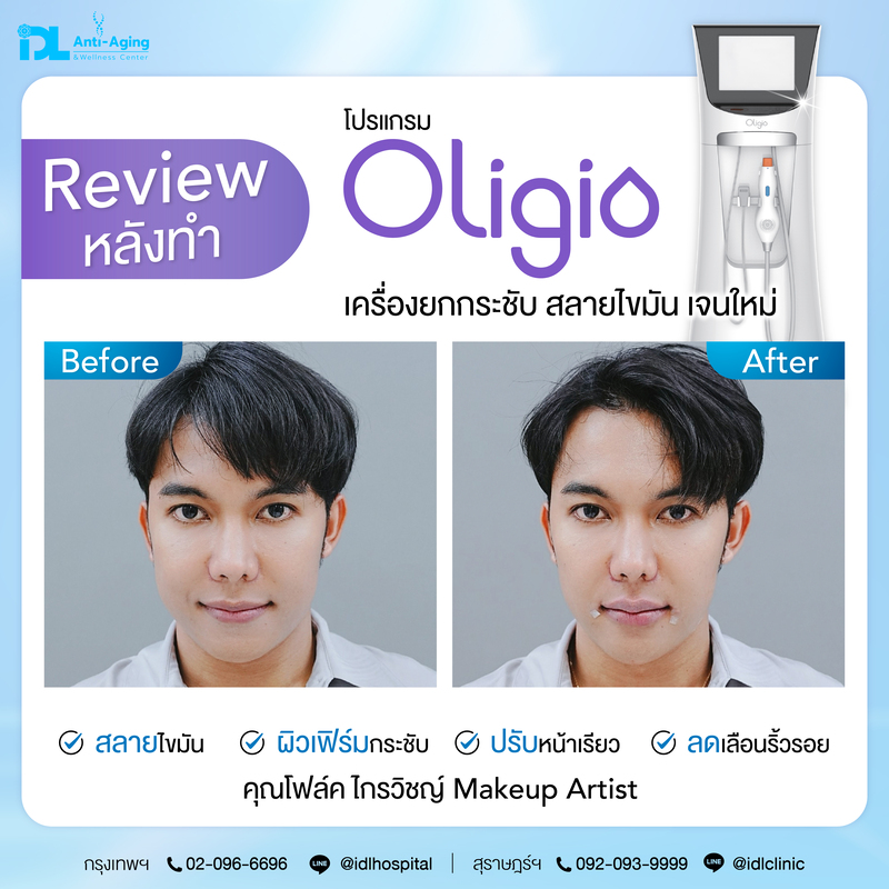 โปร Oligio