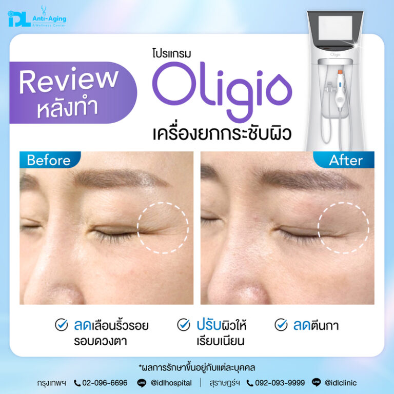 รีวิว Oligio