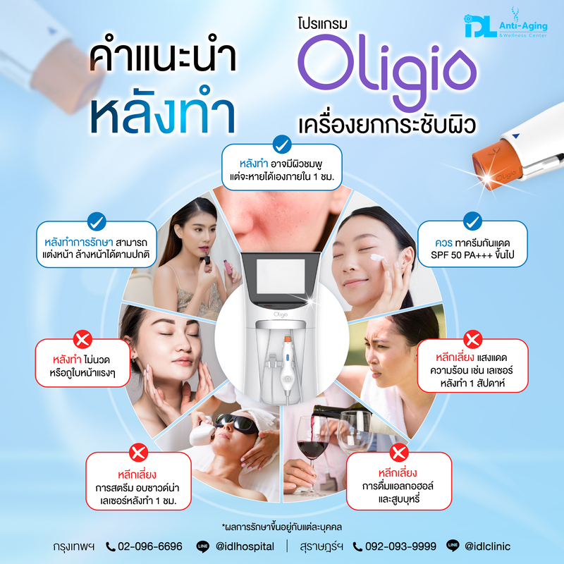 คำแนะนำ Oligio