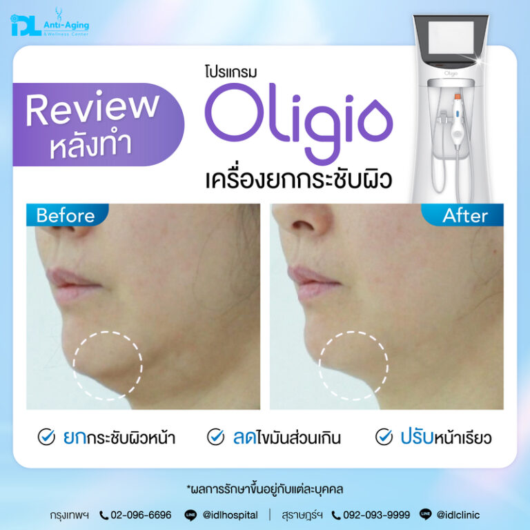 Oligio รีวิว
