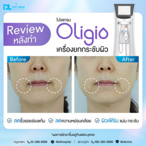 Oligio รีวิว