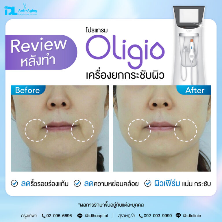 Oligio รีวิว