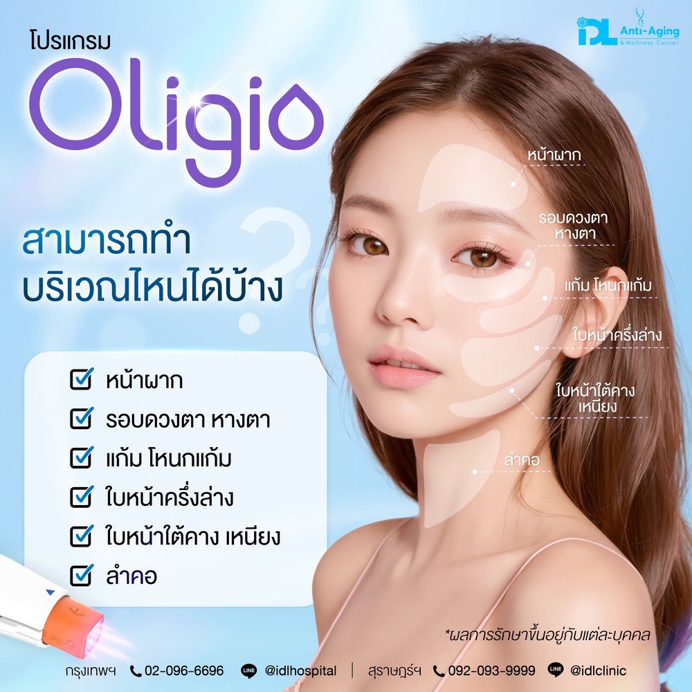 oligio ทำบริเวณไหนได้บ้าง