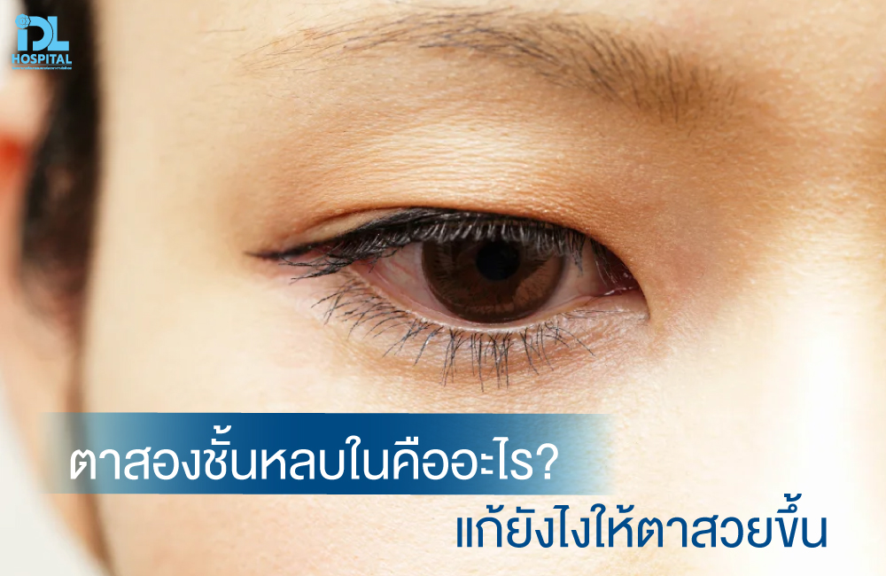 ปก ตาสองชั้นหลบในคืออะไร แก้ยังไงให้ตาสวยขึ้น