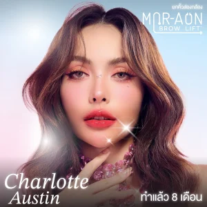 รีวิวลูกค้าที่ทำศัลยกรรมยกคิ้ว