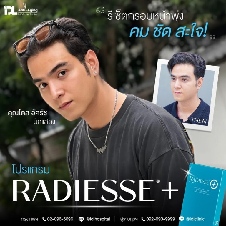 Radiesse+ เรเดียส พลัส
