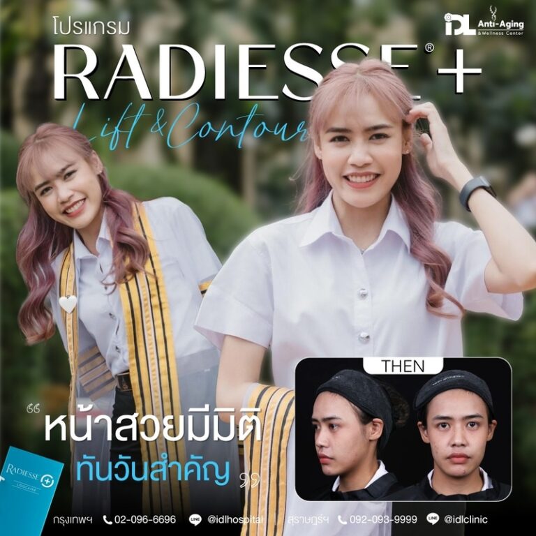 Radiesse+ เรเดียส พลัส