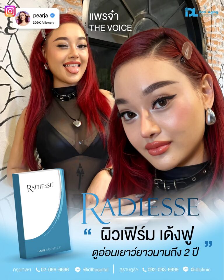 รีวิวลูกค้าฉีดเรเดียส (Radiesse) กับ IDL Hospital