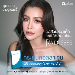 รีวิวลูกค้าฉีดเรเดียส (Radiesse) กับ IDL Hospital