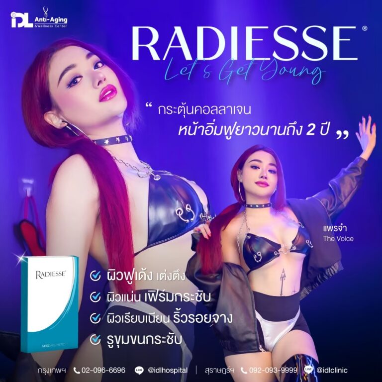 รีวิวลูกค้าฉีดเรเดียส (Radiesse) กับ IDL Hospital