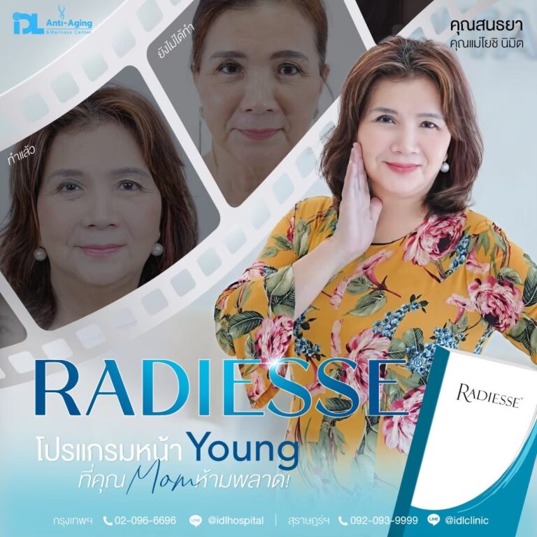 รีวิวลูกค้าฉีดเรเดียส (Radiesse) กับ IDL Hospital