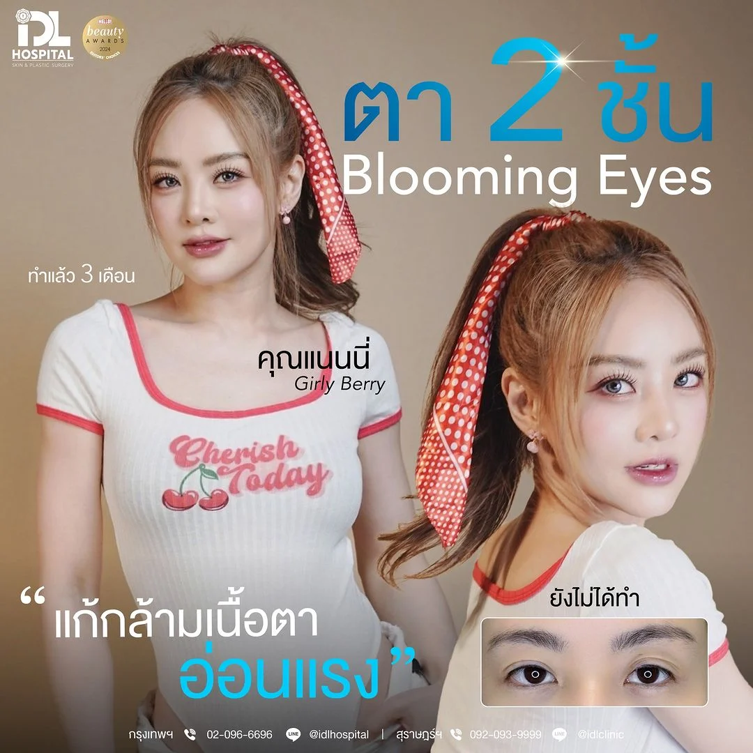 ทำตาที่ไหนดี บลูมมิ่งอาย (BLOOMING EYES)