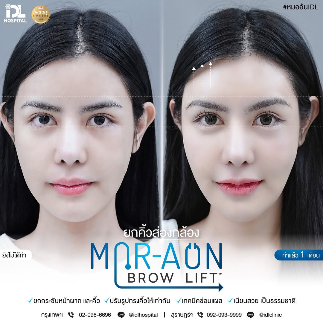 รีวิว ยกคิ้วส่องกล้อง