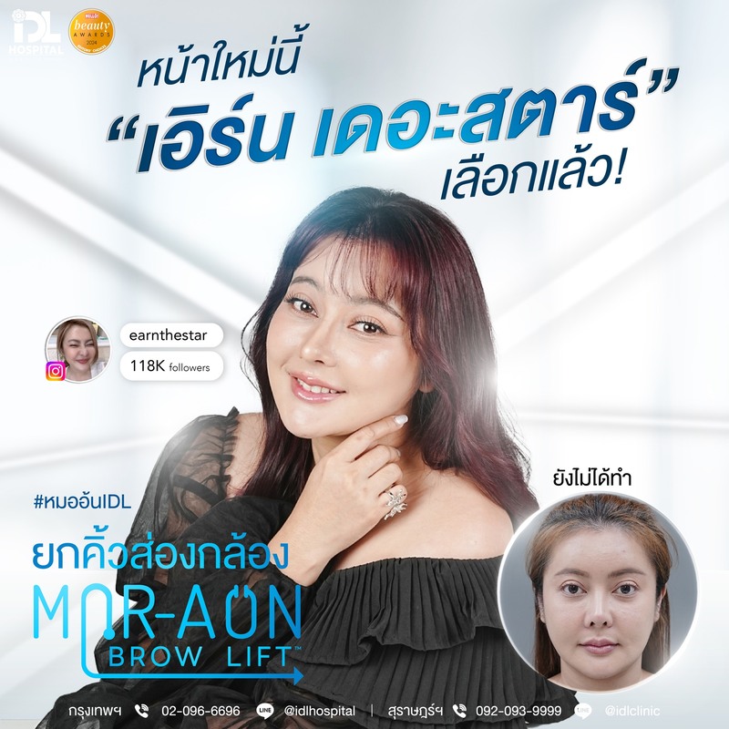 รีวิว ยกคิ้วส่องกล้อง