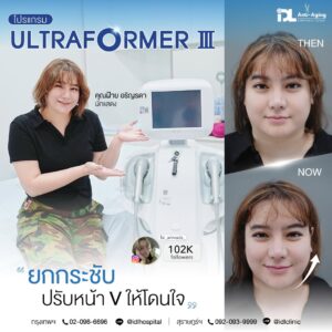 Ultraformer