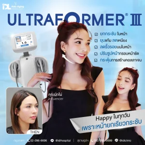 Ultraformer