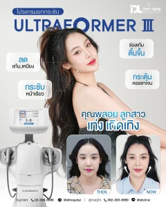 Ultraformer