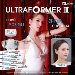 Ultraformer
