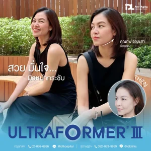 Ultraformer